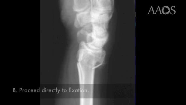 AAOS 2015 Annual Meeting Las Vegas Nevada