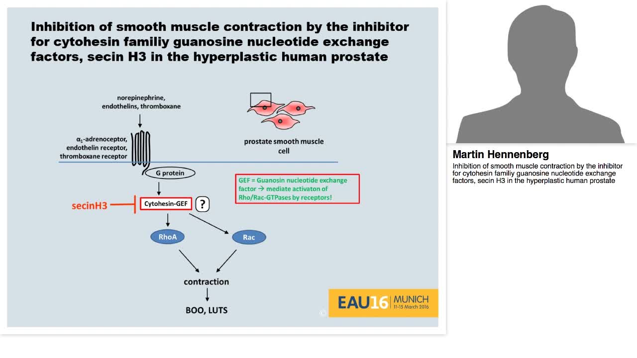 Inhibition of smooth muscle contraction by the inhibitor -