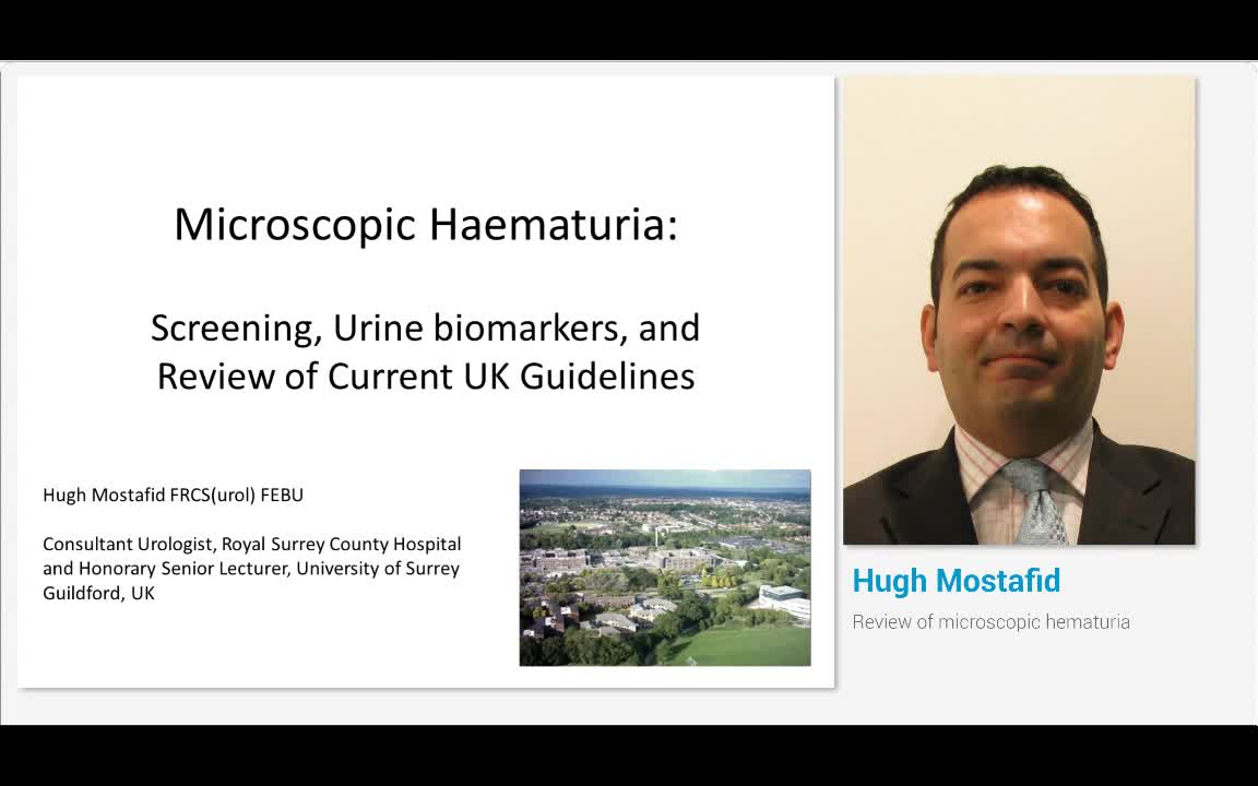 Review of microscopic hematuria