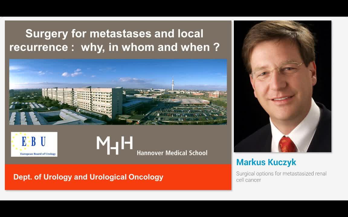 Surgical options for metastasized renal cell cancer