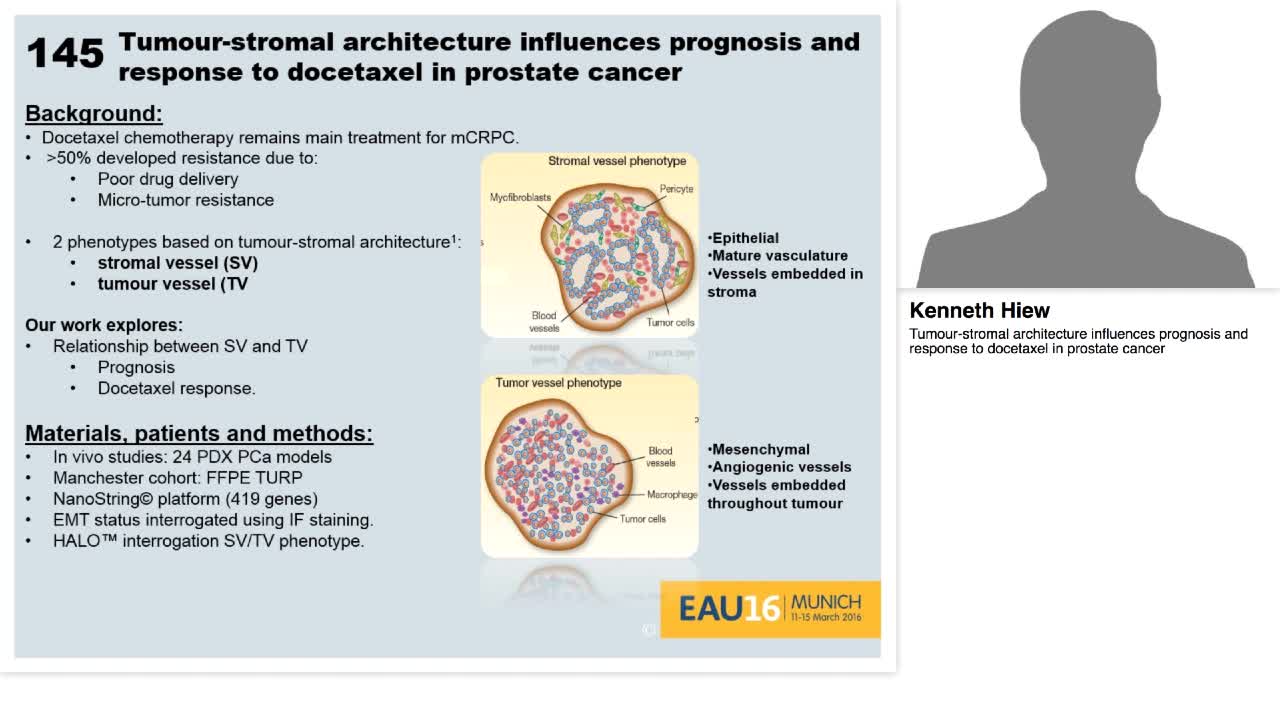 Tumour-stromal architecture influences prognosis and resp-