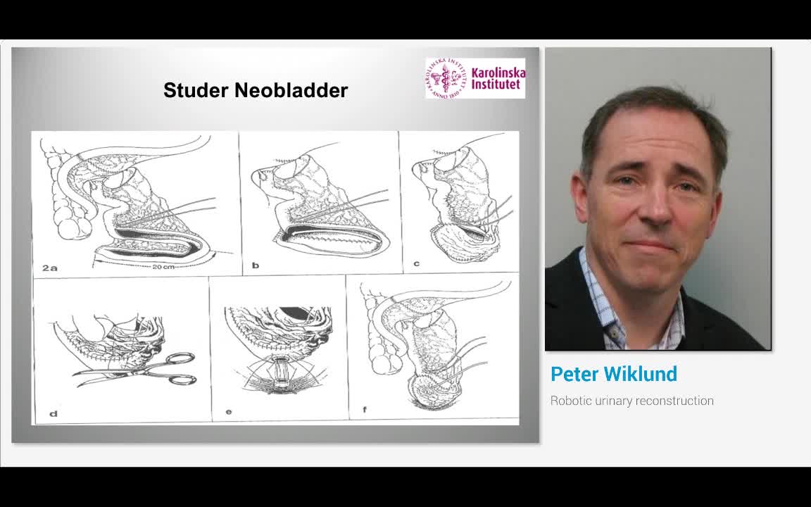 Robotic urinary reconstruction
