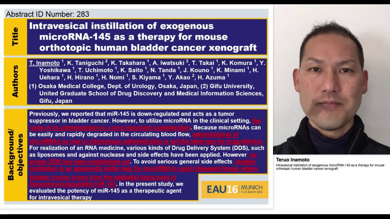 Intravesical instillation of exogenous microRNA-145 as a -