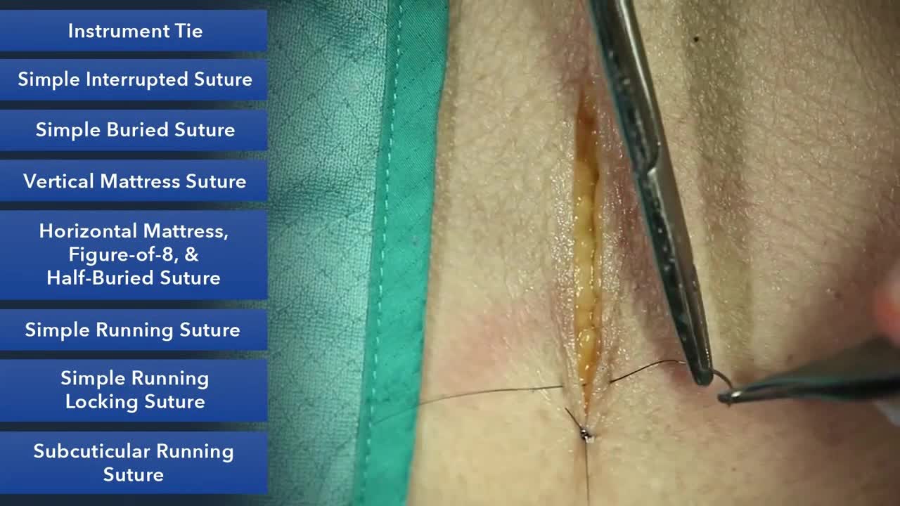 杜克缝合手术技能课程（4）