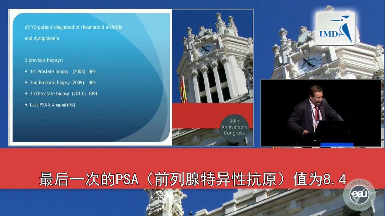 经直肠超声前列腺活检（1）