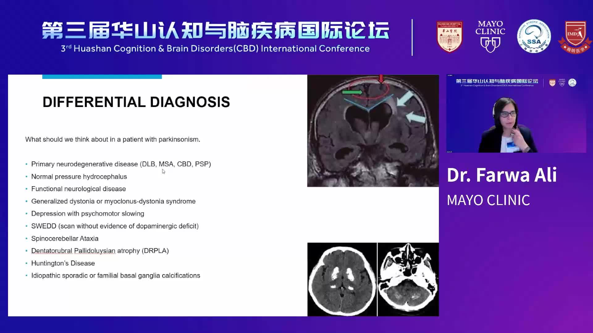 Parkinson's Disease--Dr.Farwa Ali 2