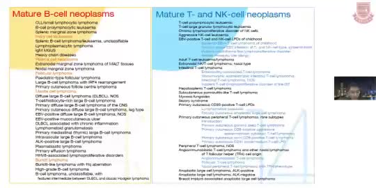 李召-结外NKT细胞淋巴瘤诊治