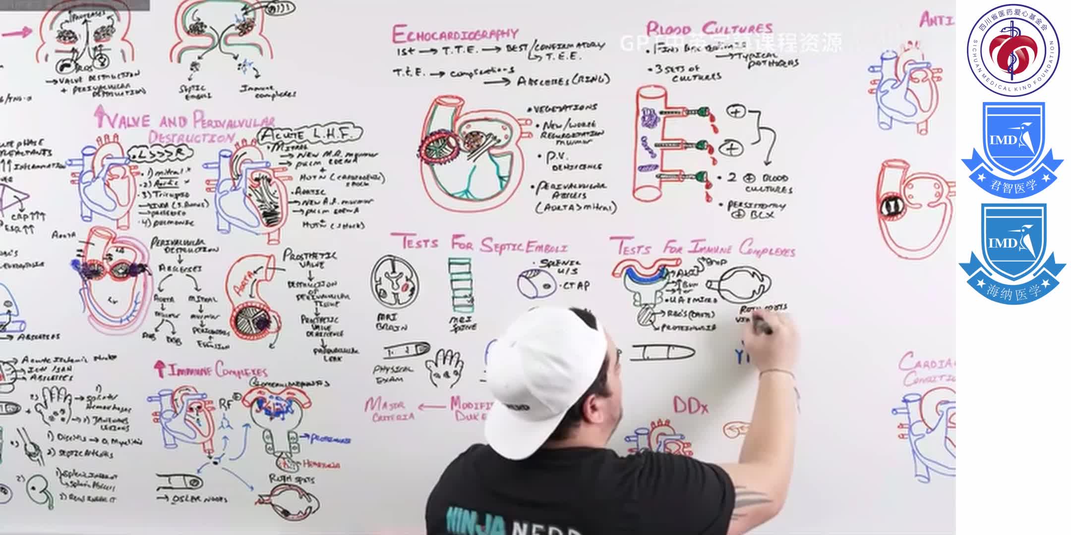 Infective Endocarditis 9