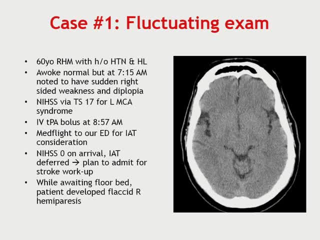 Difficult Decision-Making in Acute Stroke Tools and Resources for Management of Unstable Patients