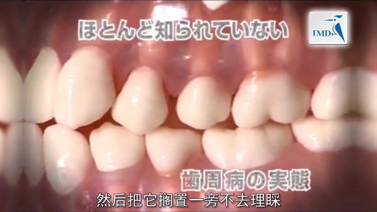 关于牙周炎检查的说明（1）