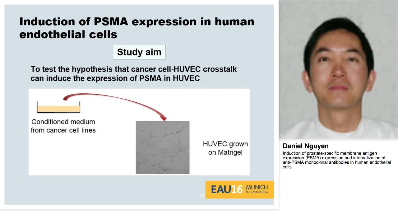 Induction of prostate-specific membrane antigen expressio-