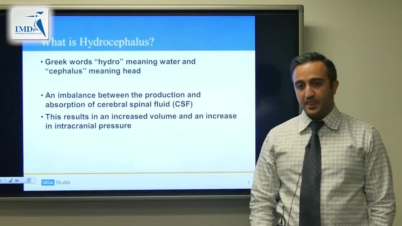 小儿脑积水管理