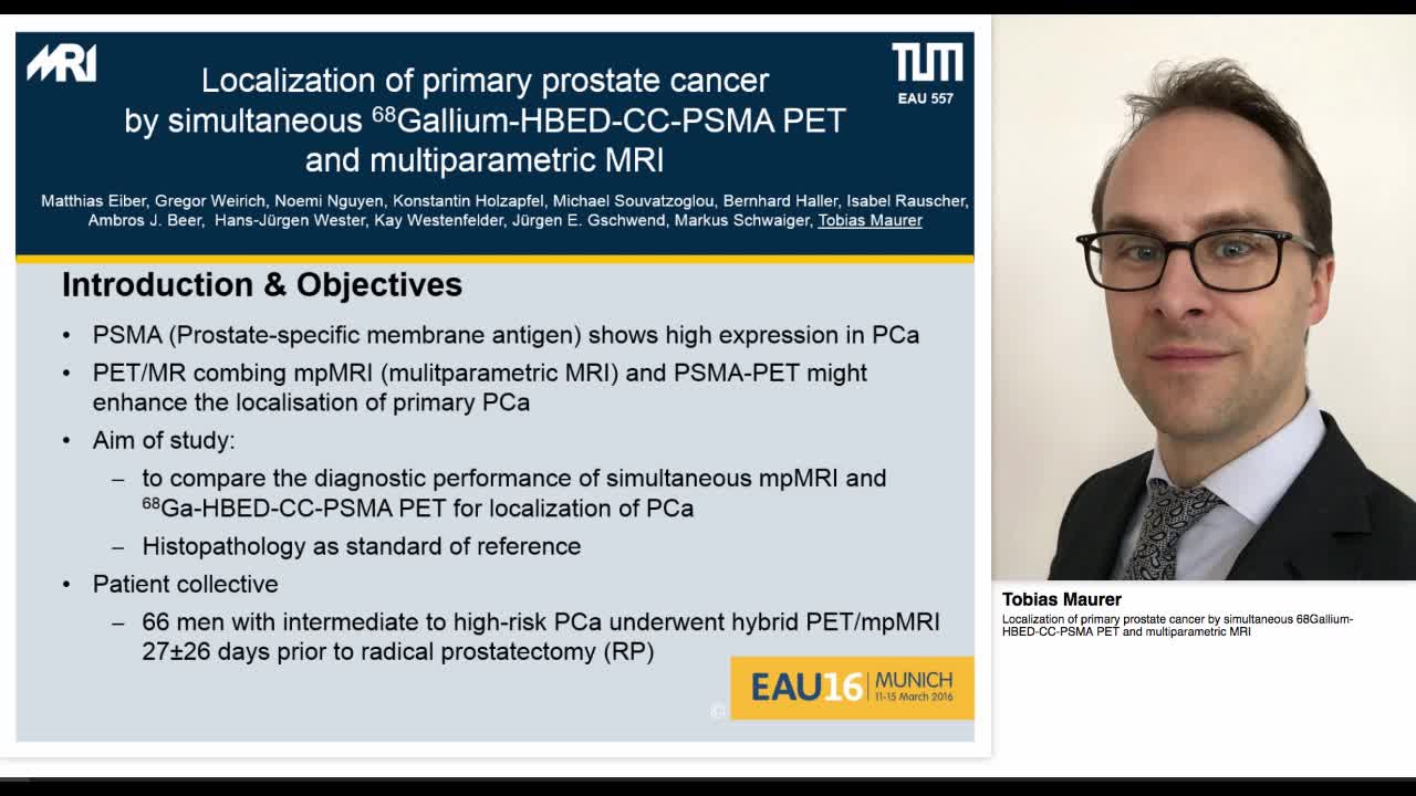 Localization of primary prostate cancer by simultaneous 6-