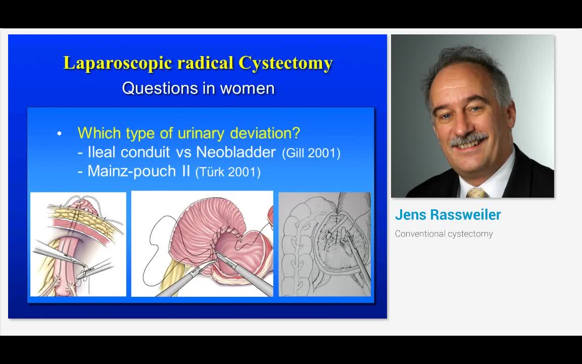 Conventional cystectomy