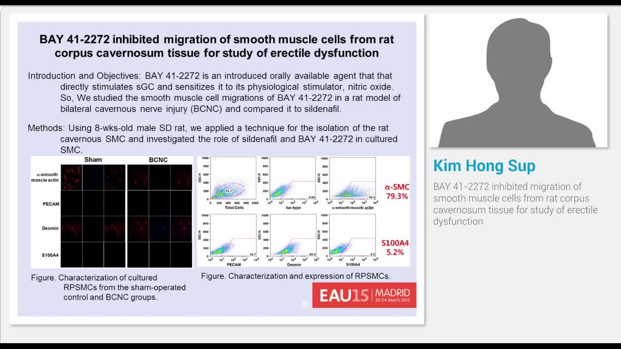 BAY 41-2272 inhibited migration of smooth muscle cells fr..-