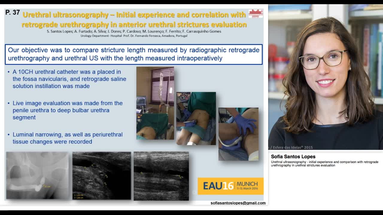 Urethral ultrasonography - initial experience and compari-