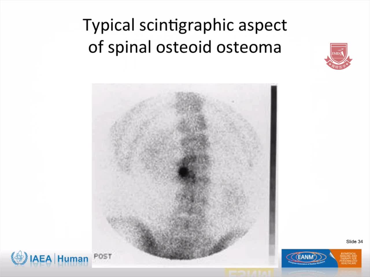 儿科：非肿瘤性骨闪烁显像3
