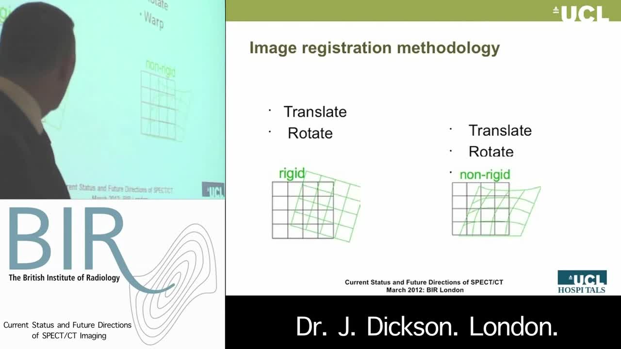 为何使用SPECT和CT技术（2）
