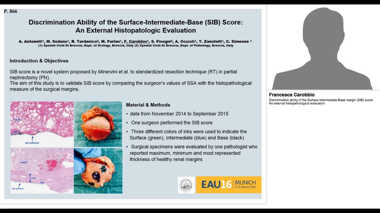 Discrimination ability of the Surface-Intermediate-Base m-