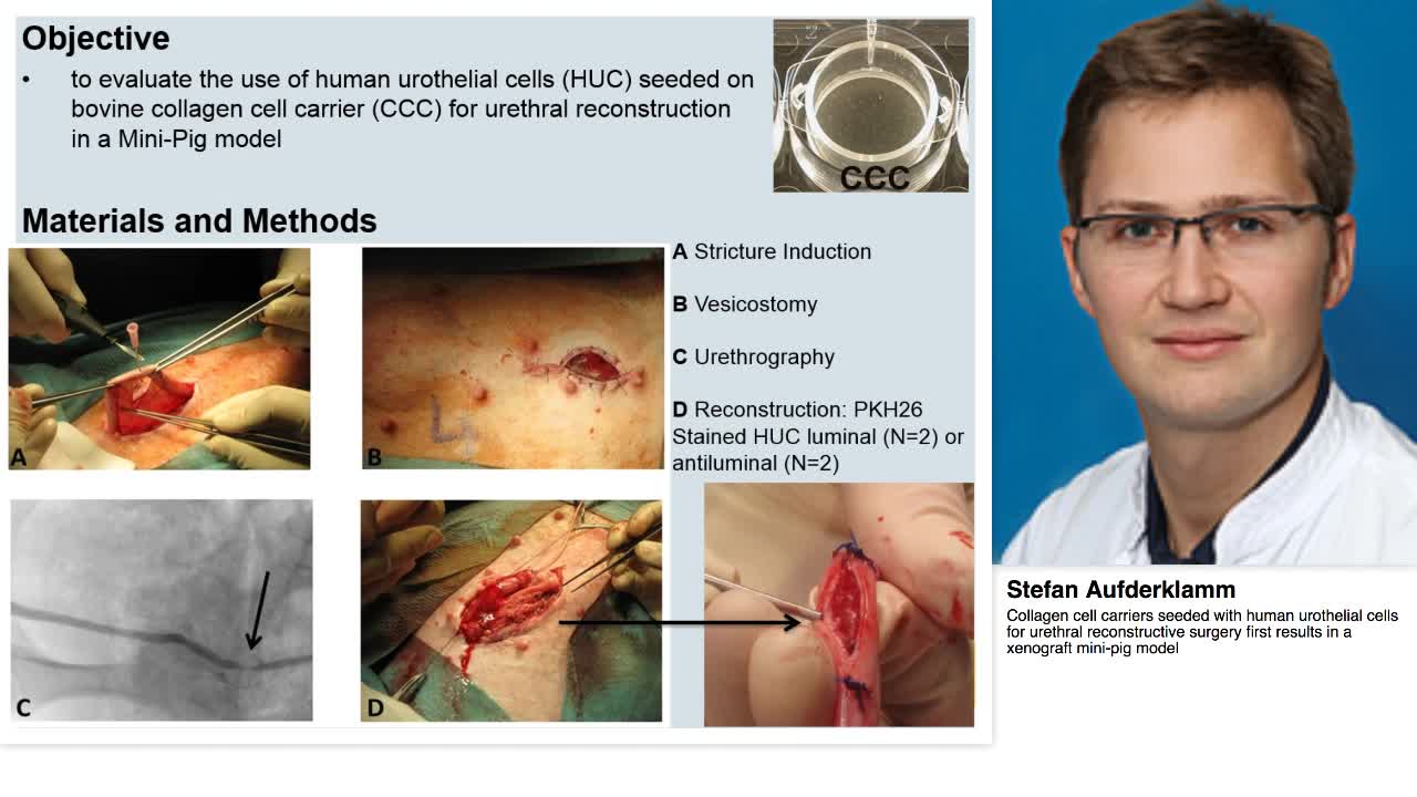 Collagen cell carriers seeded with human urothelial cells-