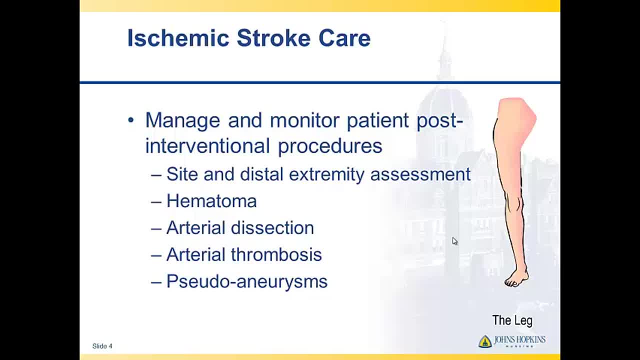 课程6-5：急性护理&mdash;&mdash;缺血性中风治疗