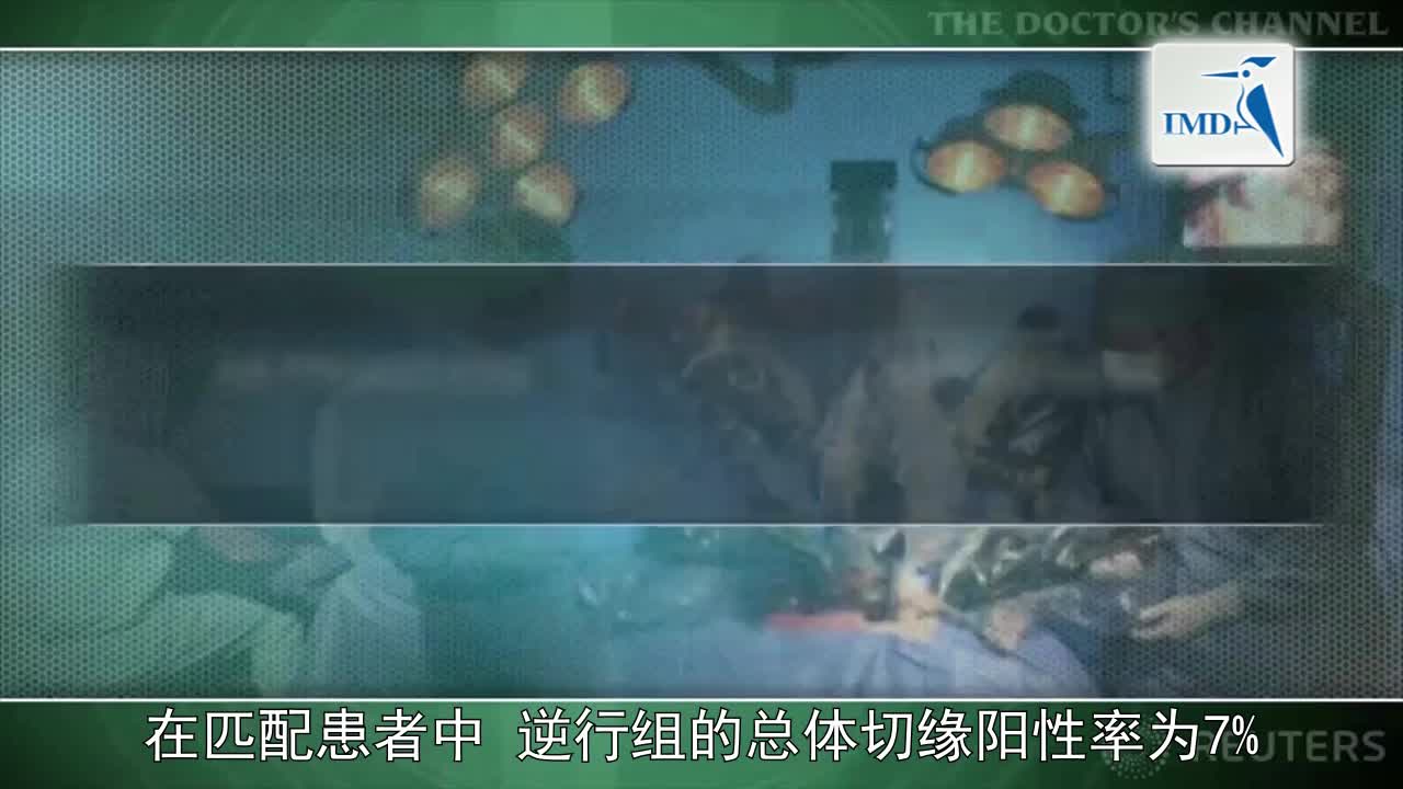 前列腺切除术中逆行神经保留可改善性功能恢复