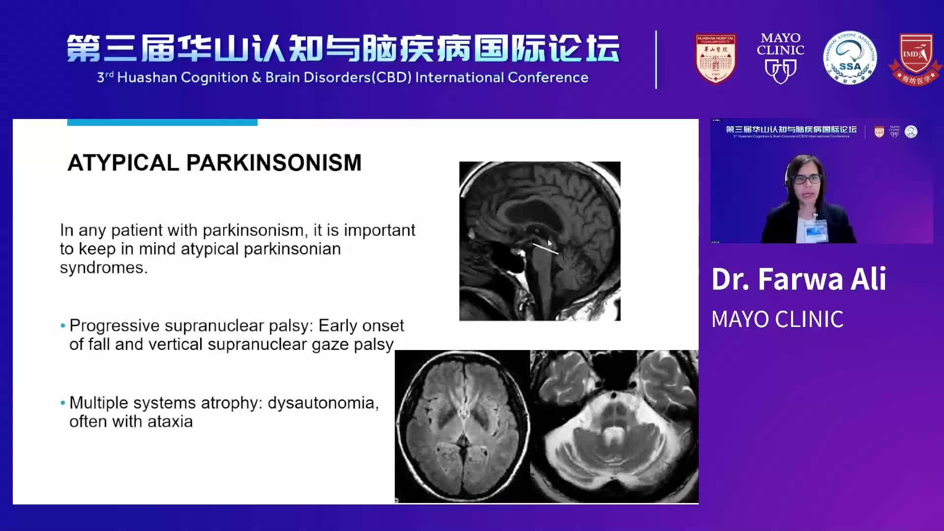 Parkinson's Disease--Dr.Farwa Ali 3
