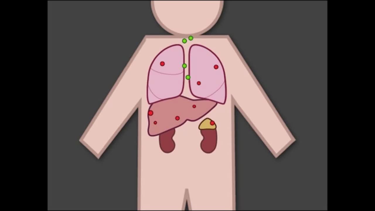 寄生虫可传染癌症