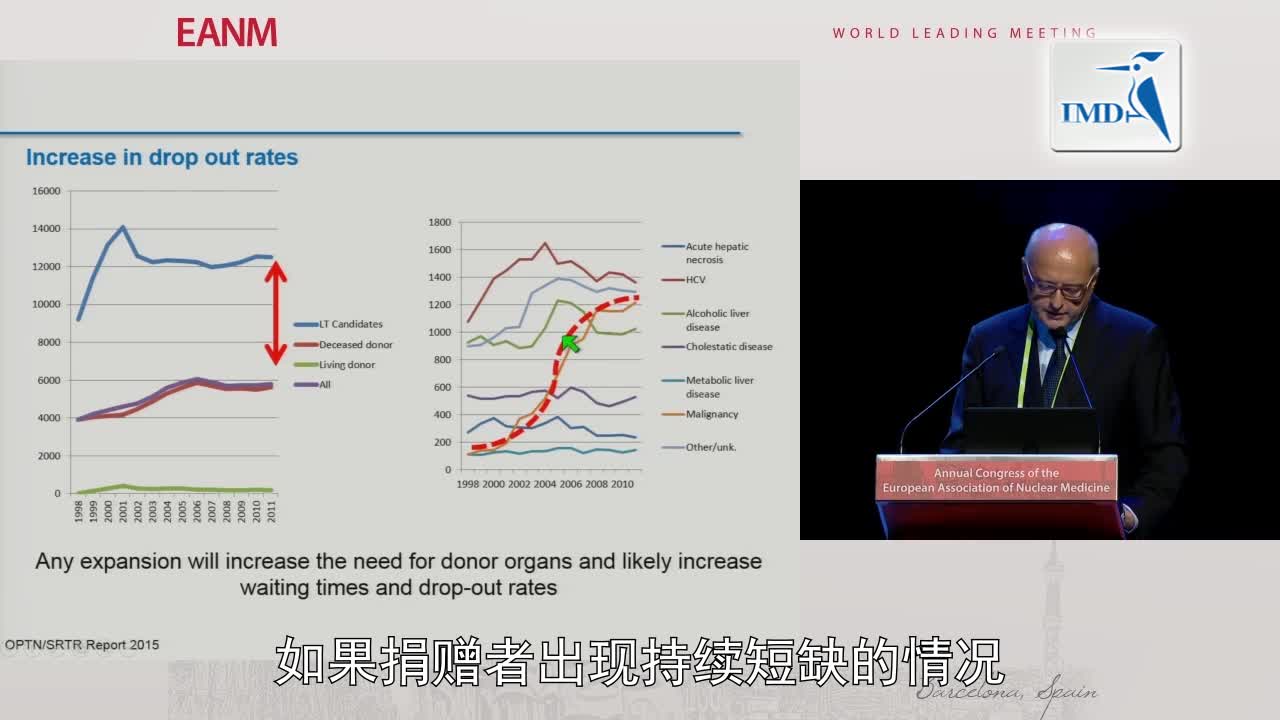肝肿瘤的治疗选择：肝脏移植（2）