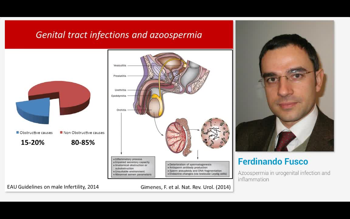 伴随泌尿生殖系统感染和炎症的无精症
