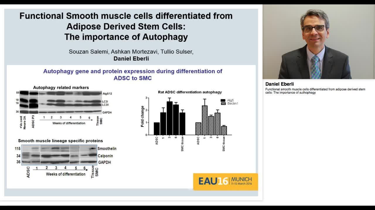 Functional smooth muscle cells differentiated from adipos-