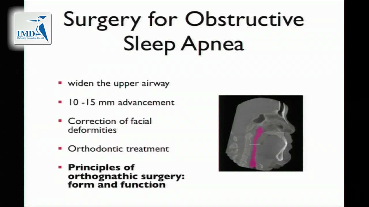 下巴微创整形手术（4）