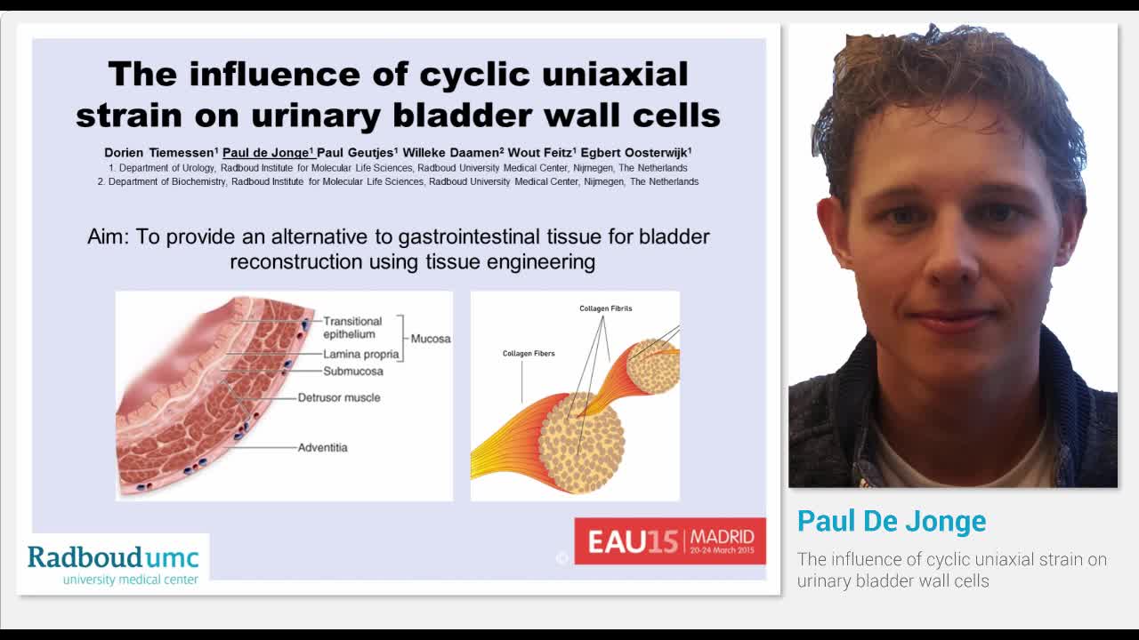 The influence of cyclic uniaxial strain on urinary bladde..-