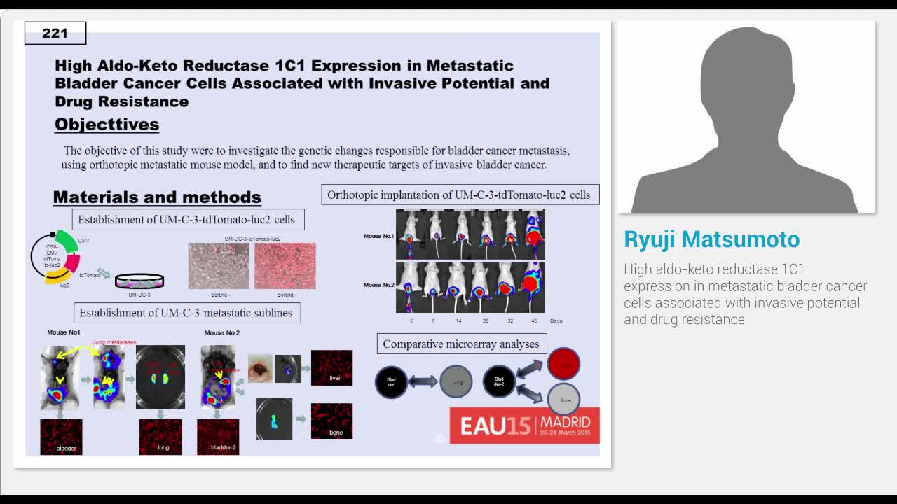 High aldo-keto reductase 1C1 expression in metastatic bla..-
