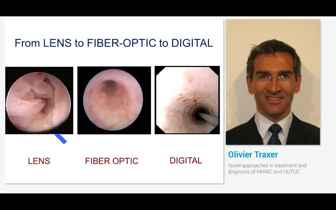 Novel approaches in treatment and diagnosis of NMIBC and ..-