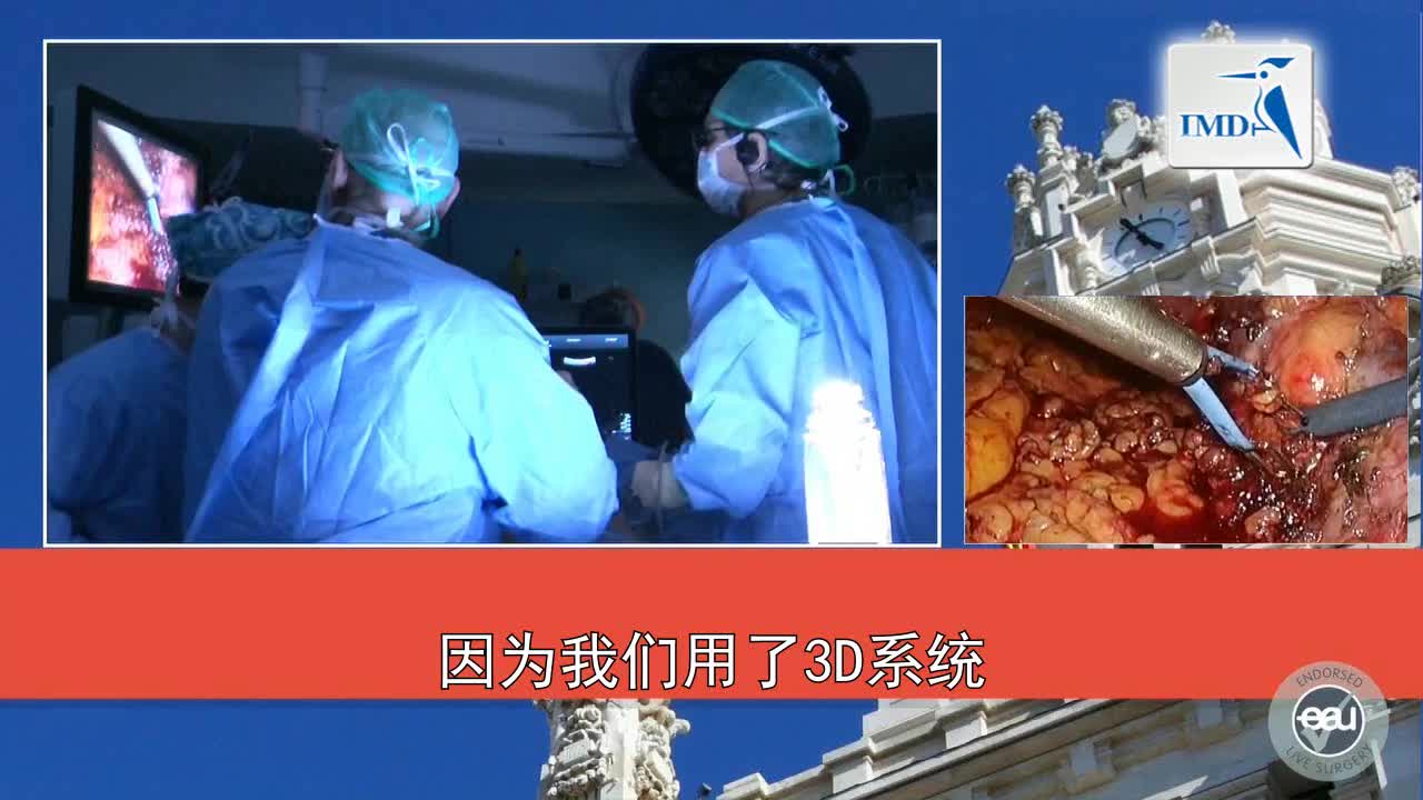 3D-HD腹腔镜肾部分切除术（2）