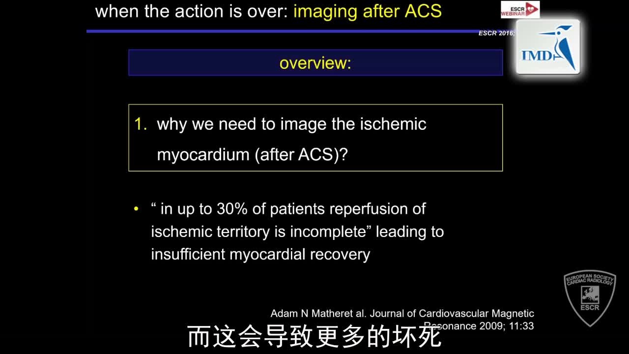 急性冠状动脉综合征发作后的影像诊断（4）