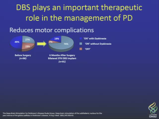 Clinical outcomes in Parkinson's disease for asleep deep brain stimulation with electrodes placed using intraoperative imaging v