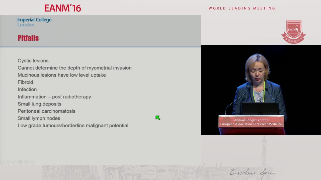 乳腺和妇科肿瘤4