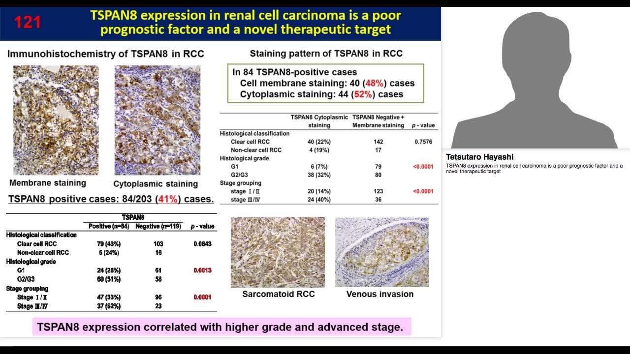 TSPAN8 expression in renal cell carcinoma is a poor progn-