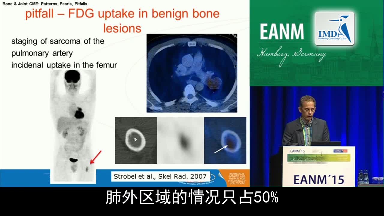 骨骼与关节继续医学教育-误区（3）