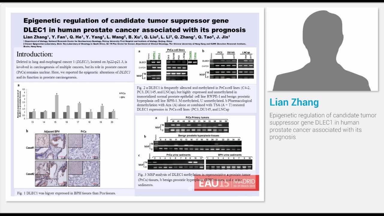 Epigenetic regulation of candidate tumor suppressor gene ..-