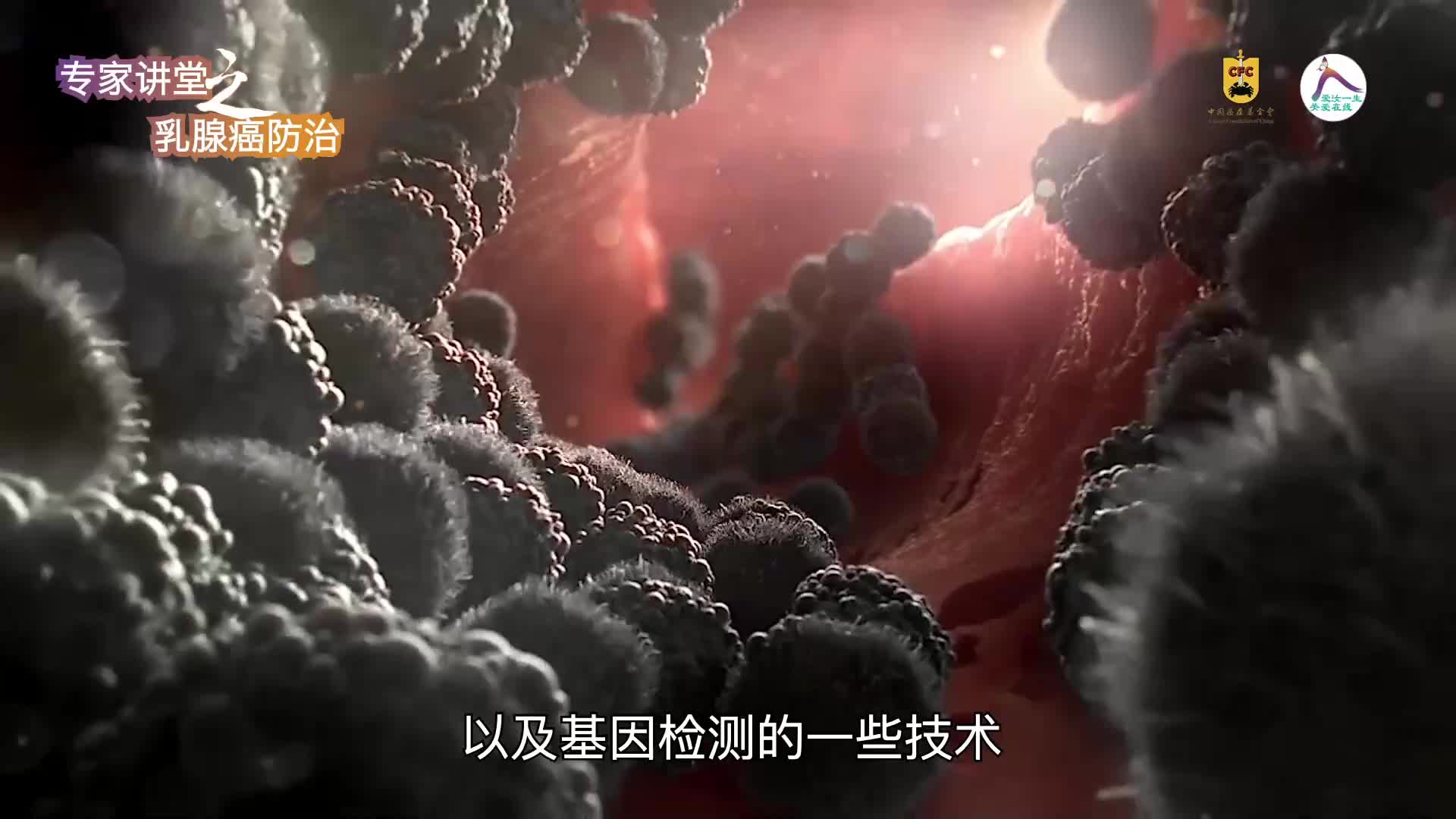 37 余腾骅--乳腺癌精准治疗浅谈