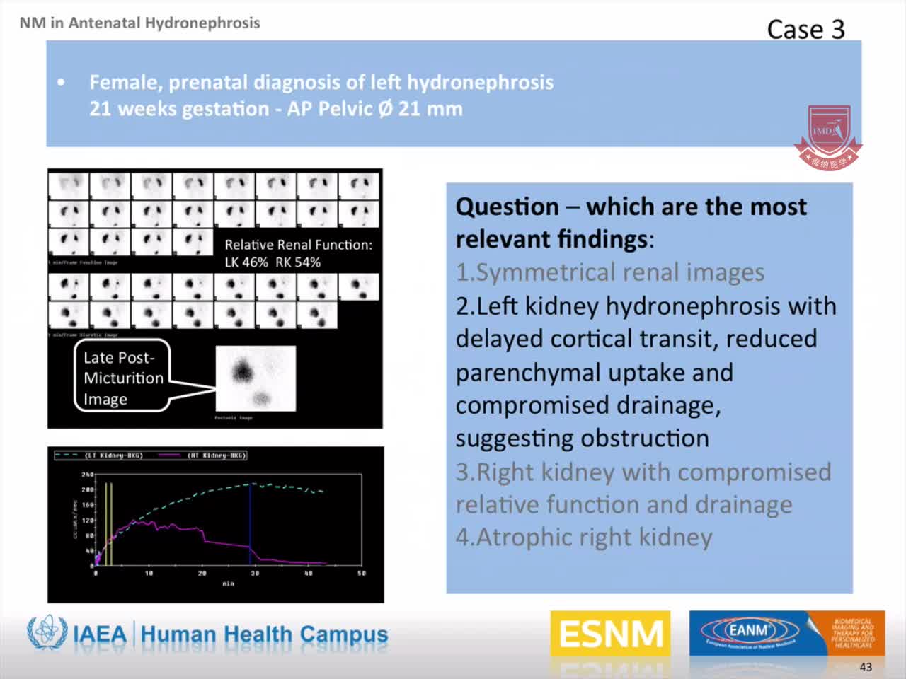 儿科：产前肾积水的核医学评价4