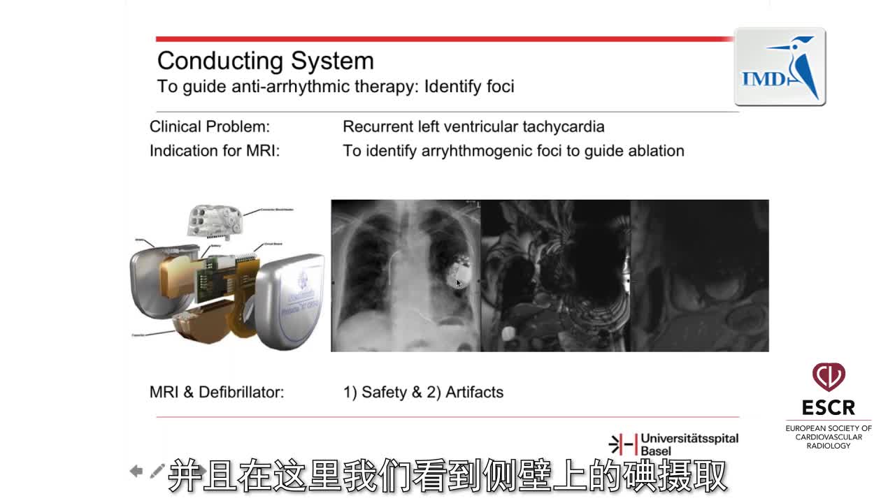 成像在器质性心脏病现代治疗中的作用 4
