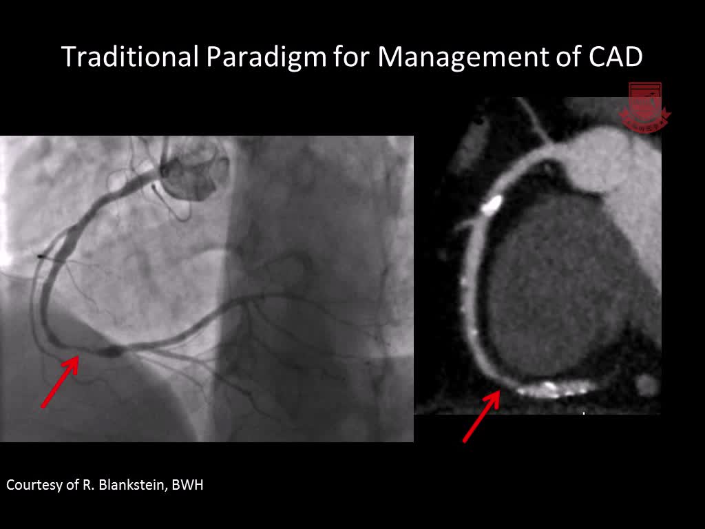 临床决策中的心肌灌注和血流1