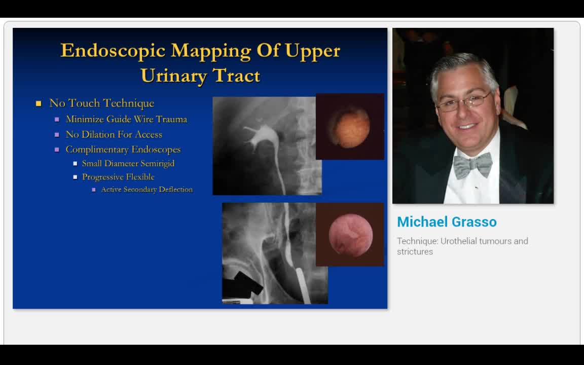 Technique, Urothelial tumours and strictures