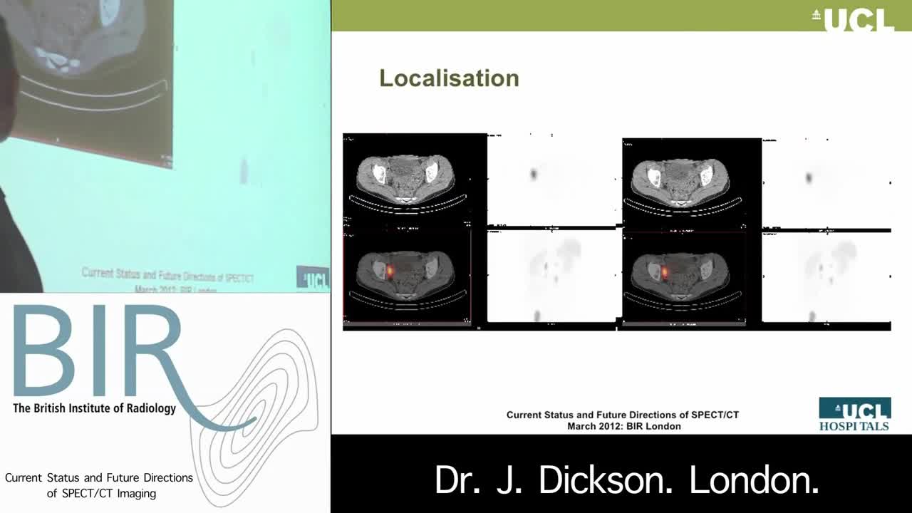 为何使用SPECT和CT技术（1）