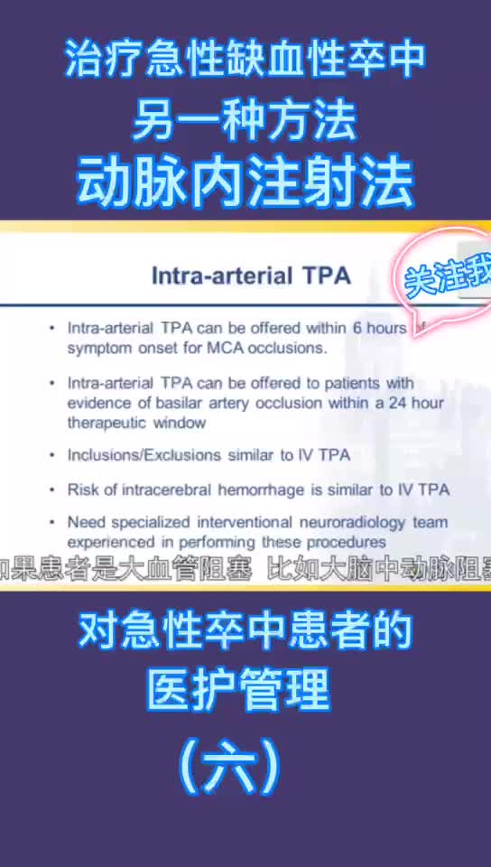 治疗急性缺血性卒中另一种方法-动脉内注射法