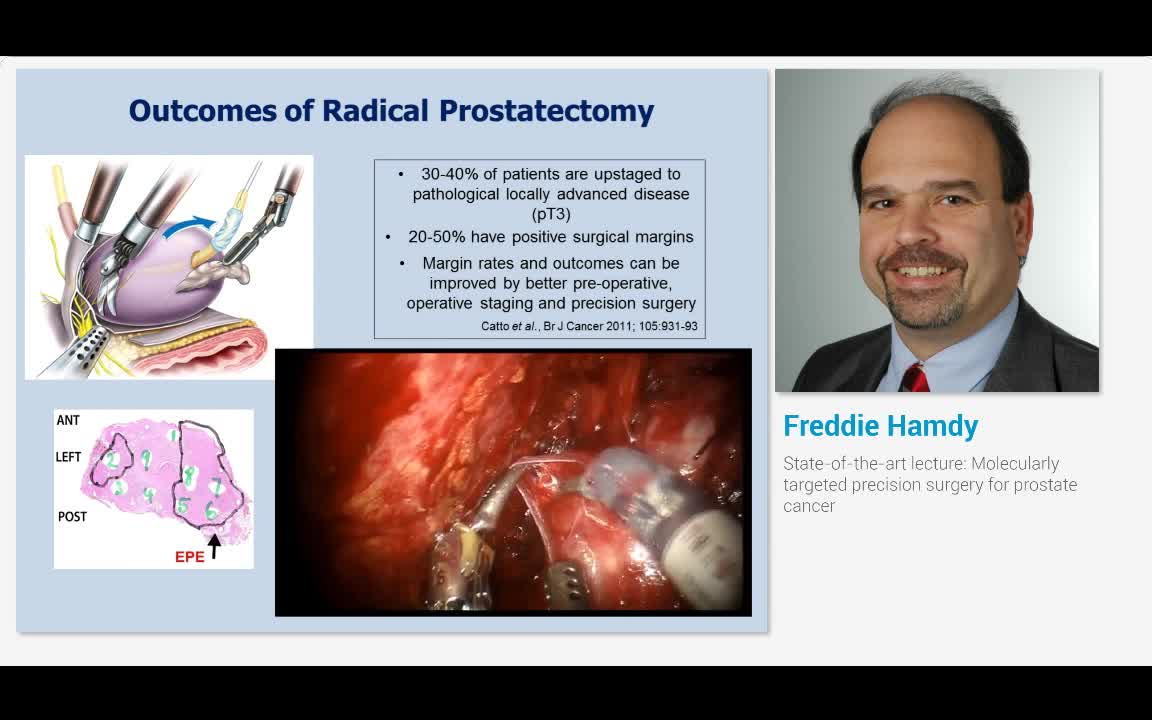 State-of-the-art lecture, Molecularly targeted precision ..-